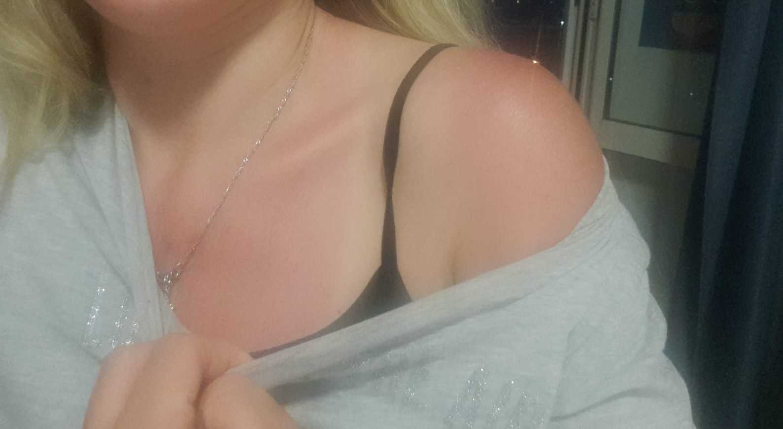 Melanoma, la prevenzione inizia a scuola: abbronzatura no scottatura