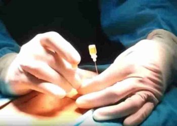 Medicina: all’Aquila corso sui metodi avanzati di neurostimolazione sacrale