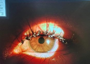 Donazioni e trapianti: convegno all’Aquila per i 20 anni della Banca degli occhi