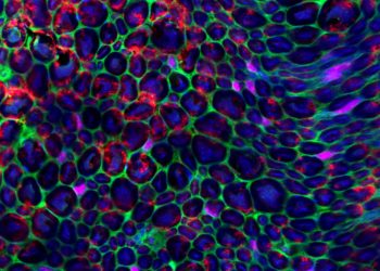 Danno neurlogico: la risposta è differente tra maschi e femmine