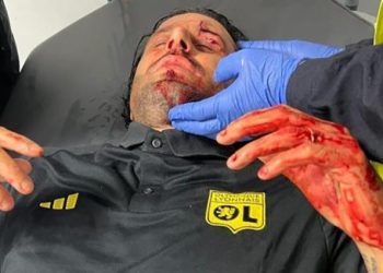 Sassi contro il pullman del Lione: ferito a Marsiglia l’abruzzese Fabio Grosso