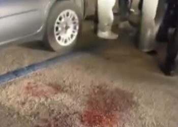 Giovane Dj pestato la sera di Pasquetta: individuati e denunciati 5 aggressori