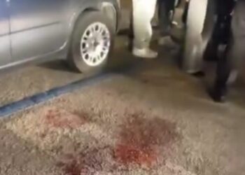 Diciottenne pestato da un gruppo di giovani la sera di Pasquetta