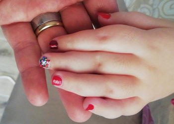 Noemi oggi compie 12 anni, senza mai arrendersi