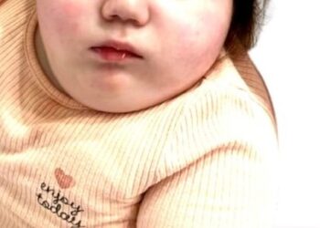 Lacrime e commozione per la scomparsa di una bimba, Sofia è volata in cielo a soli 3 anni