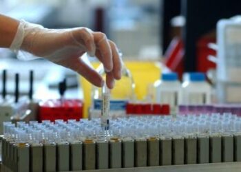 Screening Epatite C, prelievo gratuito e senza impegnativa: tutte le informazioni