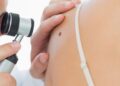 Dermatite atopica: screening gratuito, il 12 e 14 ottobre, negli ospedali di Avezzano e L’Aquila