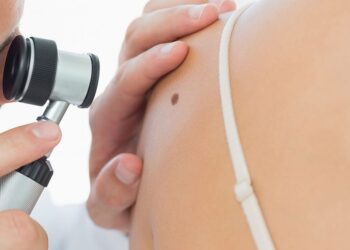 Dermatite atopica: screening gratuito, il 12 e 14 ottobre, negli ospedali di Avezzano e L’Aquila